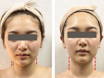TKC 東京小顔センター五反田店の写真/左右差・ゆがみ専門の「TKC式」小顔矯正で「筋膜×筋肉×骨」にアプローチし左右対称の小顔へ！男女可◎