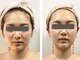 TKC 東京小顔センター五反田店の写真/左右差・ゆがみ専門の「TKC式」小顔矯正で「筋膜×筋肉×骨」にアプローチし左右対称の小顔へ！男女可◎