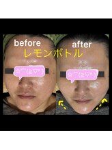 ココスタイルビューティー(COCOSTYLE beauty)/レモンボトル