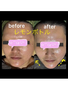 ココスタイルビューティー(COCOSTYLE beauty)/レモンボトル