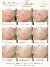 ソルカナ(Solkana)&nbsp;理想の肌を Solkanaで