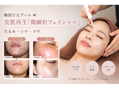 アルクラールの写真
