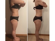 ココ(coco)/凸凹脂肪ケア☆燃焼系マッサージ