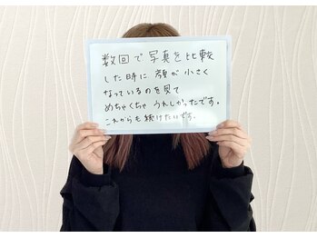 アランルージュ(ALANROUGE)/【お客様の声】小顔施術