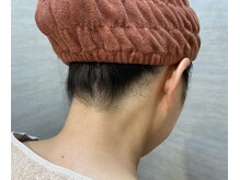 リリ(RiRi)/【脱毛】うなじ脱毛