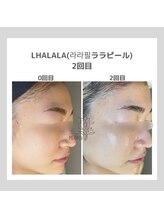 ポムハヌル 大阪梅田中崎町(pom.haneul)/韓国肌管理室