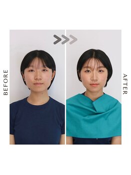 シュアリー(Surely)/トータルコースお客様事例