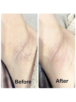 シーズン(Season)/シュガーリング