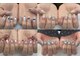 ブルームネイル(bloomnail)の写真