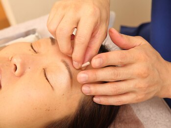 ゆるやか鍼灸接骨院/シミ・しわ・たるみに美容鍼灸