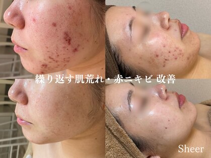 シアー(Sheer)の写真