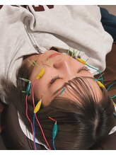 サボテン/美容鍼