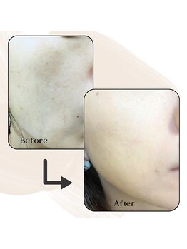 ヴィセル(VISEL)/ふっくら美肌