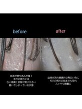 マナワ(manawa)/ヘッドスパ施術 before→after