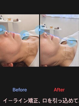 美容矯正サロン レレポノ(LELEPONO)/