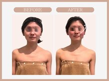 スリムライン 弘前店(The Slim Line)/before→after