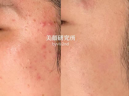美顔研究所 バイ ヴィヴセカンド(美顔研究所 by viv 2nd)の写真