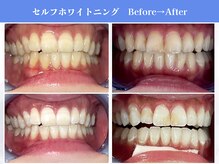 エクシアホワイトニング 岡崎店/岡崎エリア★口コミ・来店数No.1