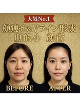 ドクターマジックタッチ(Dr.MAGIC TOUCH)/【人気No.1】Vライン劇的小顔