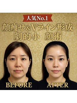 ドクターマジックタッチ(Dr.MAGIC TOUCH)/【人気No.1】Vライン劇的小顔