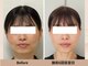 クローバー(clover)の写真/憧れの透明感肌へ☆血流を巡らせて、ワントーン明るい印象に！