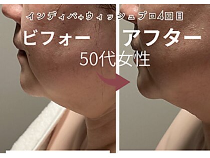 アモル(Amor)の写真