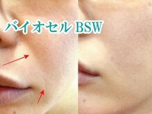 美宝 元町/美宝、最上級エステ