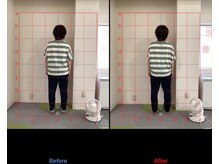 けいのき鍼灸整骨院/姿勢から身体を楽に!整体/肩こり
