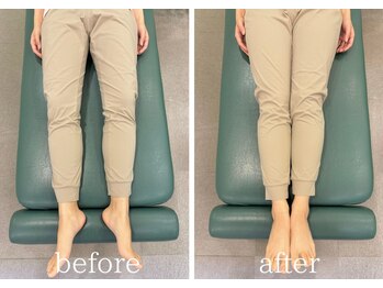 カイロラインメディカル整体 平塚院(Chiro Line)/骨盤矯正×美脚/beforeafter