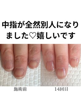 健康美爪育成コース