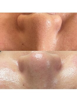 キキ(kiki)/内側からふっくら肌に