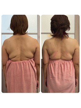 鈴木整体院 仙台泉院/小顔造顔/骨盤矯正/痩身整体