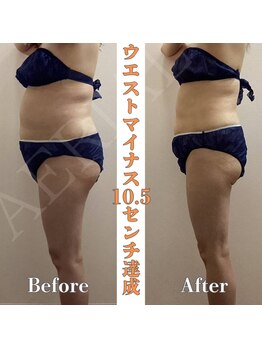 エアリアル 武雄店/エアリアルメソッド!