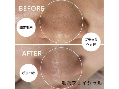 ラ スィーヌ(racine)の写真