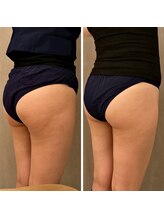 ビューティースタジオ ハンミ 福岡大名店(Beauty studio 韓美)/キャビゼロ60分