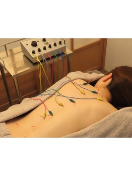 鍼灸施術を受けたい