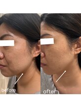 レアビューティー(Le'a beauty)/レモンボトル