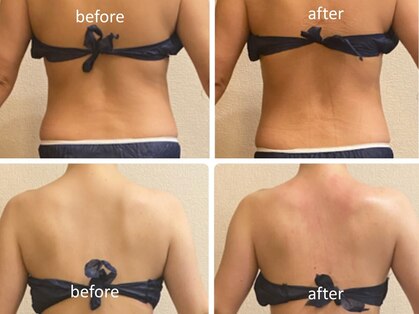 リナル 武蔵小杉店の写真