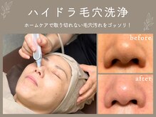  美容液の水流で毛穴すっきり、透明感のあるつるすべ肌へ