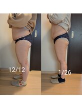 リルーチェ 倉敷(Riluce)/ぽっこりお腹撃退！