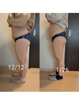 リルーチェ 倉敷(Riluce)/ぽっこりお腹撃退!