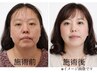 【小顔コルギ】背中＆肩＆頭＆顔まで入りしっかり触るマッサージ70分14,300→