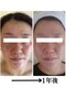 エステサロン ’Olu ’Oluの写真/肌質改善で憧れの陶器肌へ!徹底ケアで毛穴・くすみも一掃。完全個室で叶える本気の美肌体験