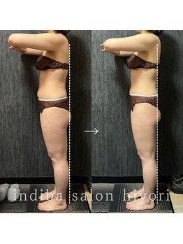 ヒヨリ(hiyori)/《before/after》反り腰改善