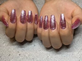 チップスカルプ[新宿/新宿三丁目