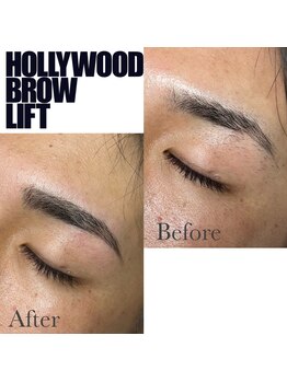 マテオ(Matteo)/ハリウッドブロウリフト/HBL