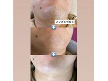 エフサロン(f salon)