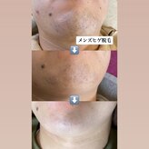 エフサロン(f salon)