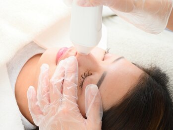 シェクラ(SHECIA)の写真/【お顔剃りで目指せ毛穴レス肌★】頑固な汚れやざらつき・毛穴開きや詰まりが気になる方に！敏感肌の方も◎