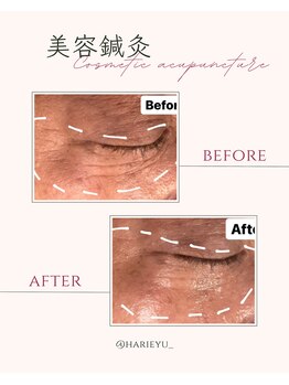 鍼灸院 ＨＡＲＩｅｙｕ/